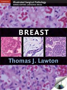 Illustrated Surgical Pathology of the Breast [With CDROM]