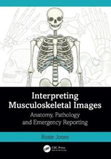 Interpreting Musculoskeletal Images: Anatomy, Pathology and Emergency Reporting