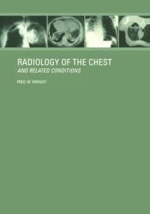 Radiology of the Chest and Related Conditions: Together with an Extensive Illustrative Collection of Radiographs, Conventional and Computed Tomograms,