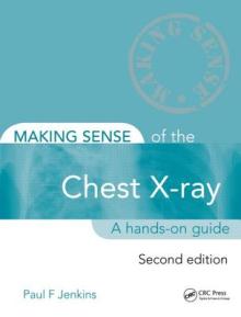 Making Sense of the Chest X-Ray: A Hands-On Guide