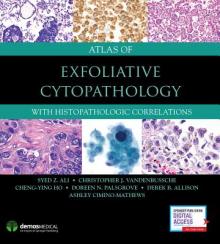 Atlas of Exfoliative Cytopathology: With Histopathologic Correlations