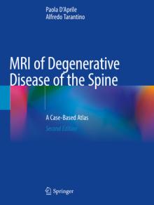 MRI of Degenerative Disease of the Spine: A Case-Based Atlas