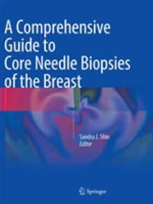 A Comprehensive Guide to Core Needle Biopsies of the Breast