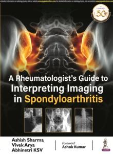 Rheumatologist's Guide to Interpreting Imaging in Spondyloarthritis