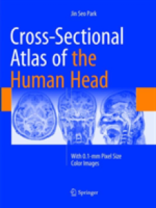 Cross-Sectional Atlas of the Human Head: With 0.1-MM Pixel Size Color Images