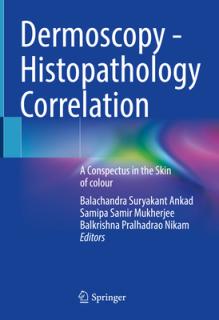 Dermoscopy - Histopathology Correlation: A Conspectus in the Skin of Colour